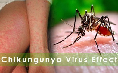 KHUYẾN CÁO PHÒNG CHỐNG BỆNH CHIKUNGUNYA